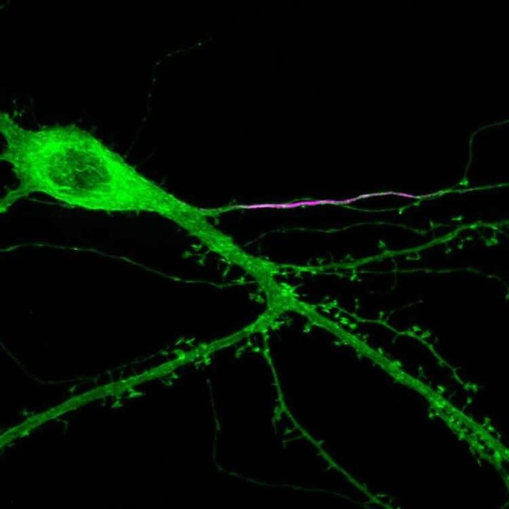 Medicina-La-sinestesia-puede-ser-resultado-de-neuronas-hiperconectadas