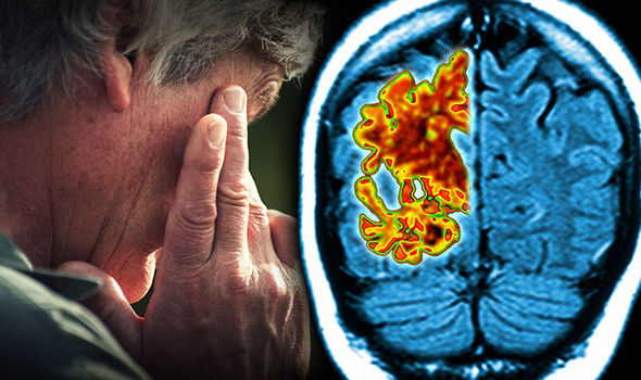 No-habrá-nuevos-medicamentos-contra-el-Alzheimer-hasta-en-15-años No-habrá-nuevos-medicamentos-contra-el-Alzheimer-hasta-en-15-años