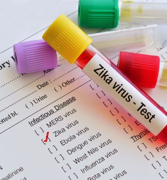 El-ARN-del-virus-del-Zika-se-identifica-en-el-semen-de-los-hombres-con-infección-sintomática