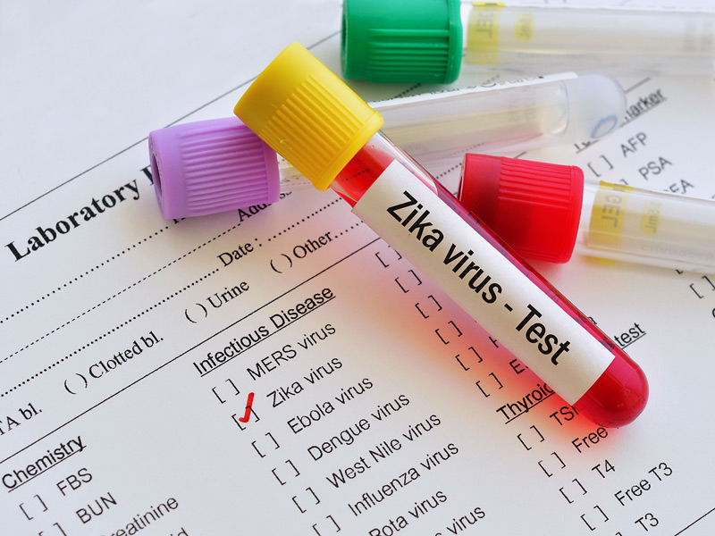 El-ARN-del-virus-del-Zika-se-identifica-en-el-semen-de-los-hombres-con-infección-sintomática