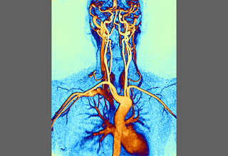 Medicamentos-antidiabéticos-y-riesgos-cardiovasculares-perspectivas